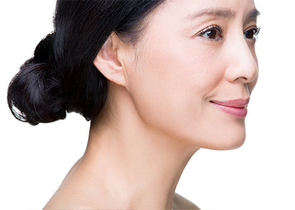 팔자주름 치료 (스마일 라인 교정)