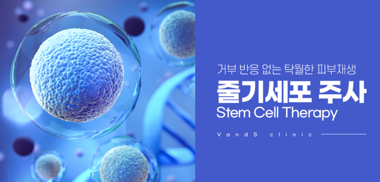 Stem Cell Injection