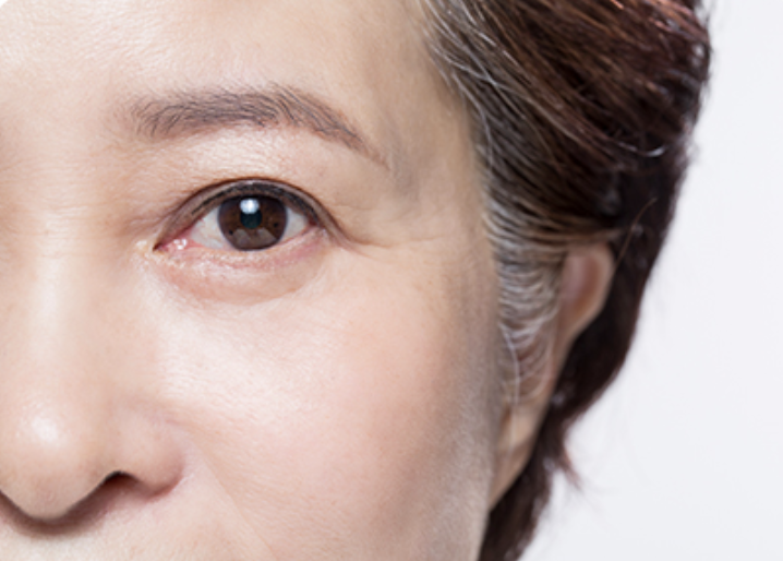 Stem-Cell Lifting – Full Face
