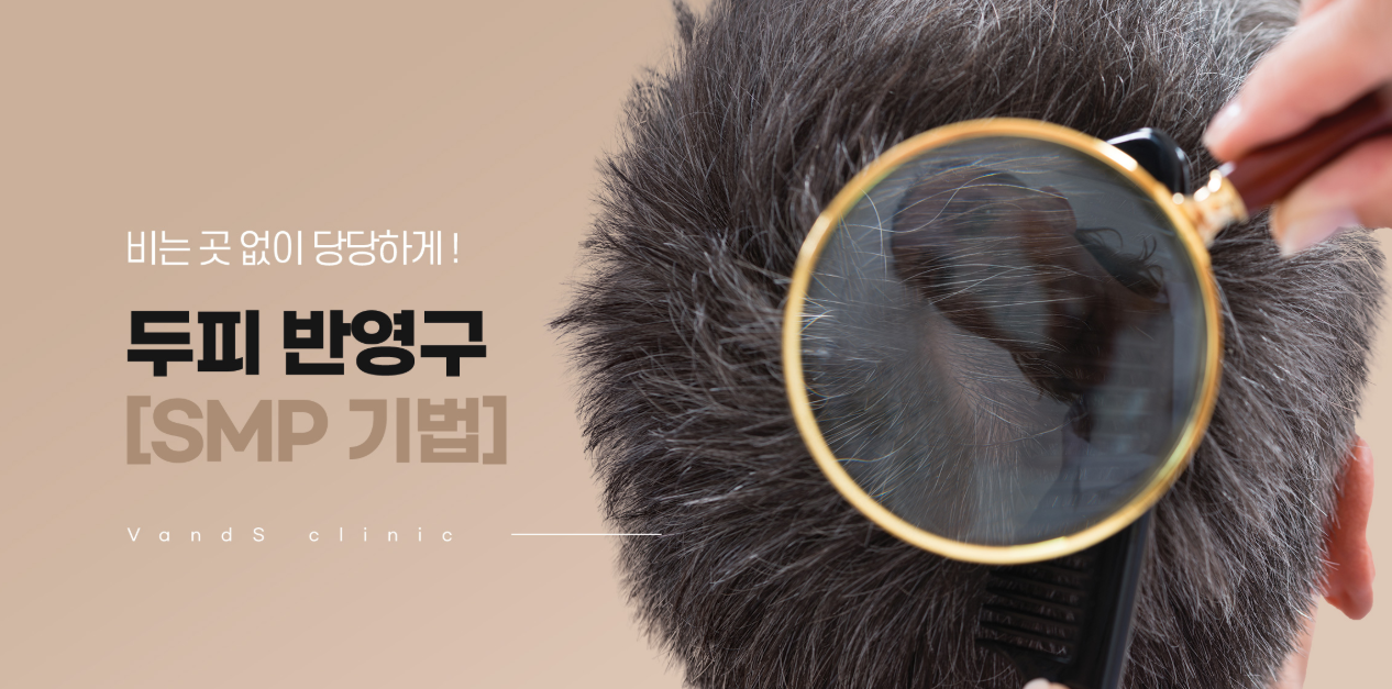 SMP 头皮微色素沉着（SMP 头发纹身）