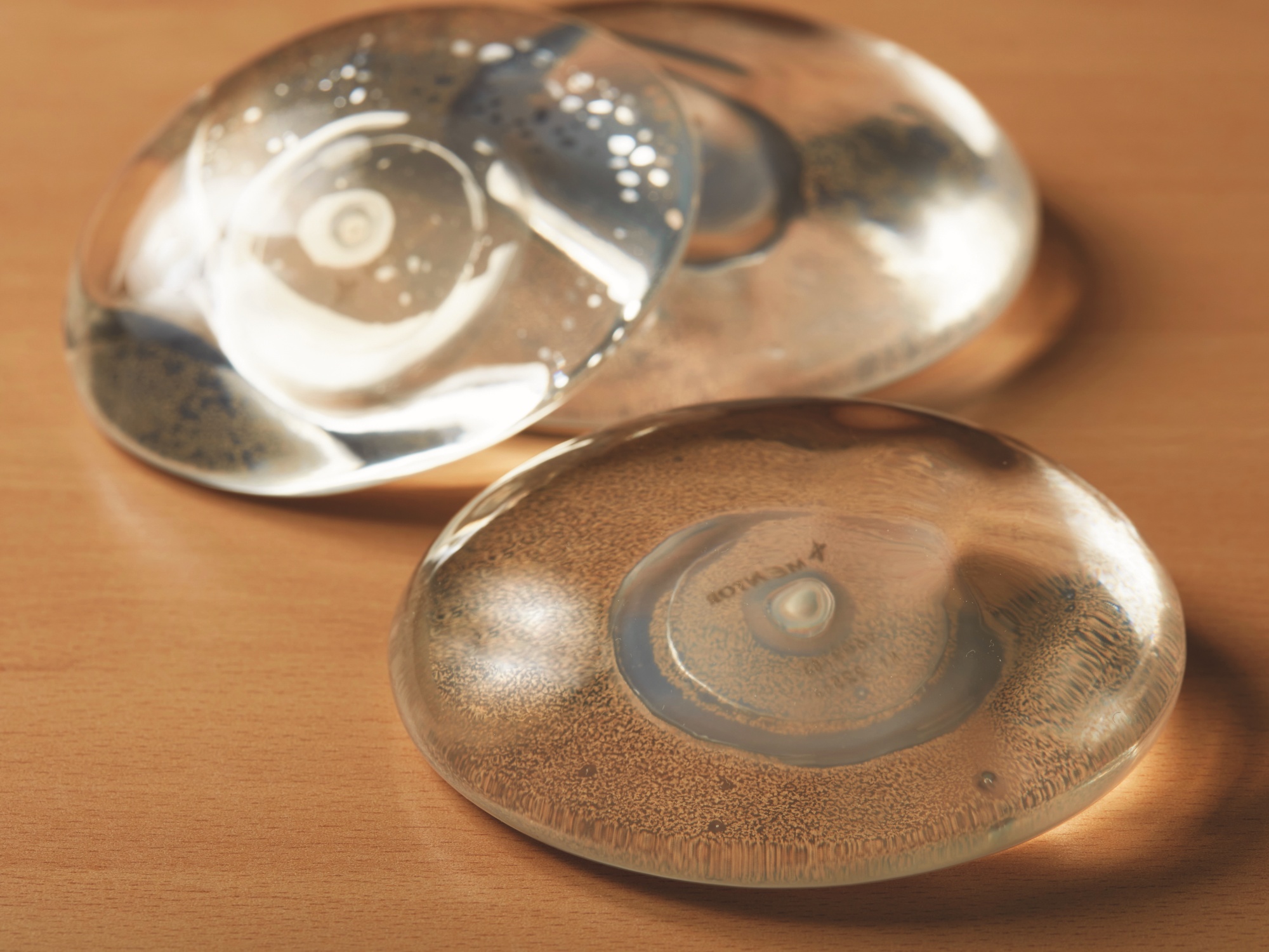 가슴 재건 수술