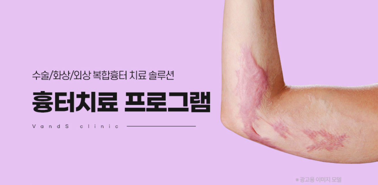 흉터 치료 프로그램
