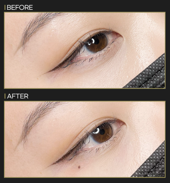 美人ぼくろ作成(ミインぼくろ)