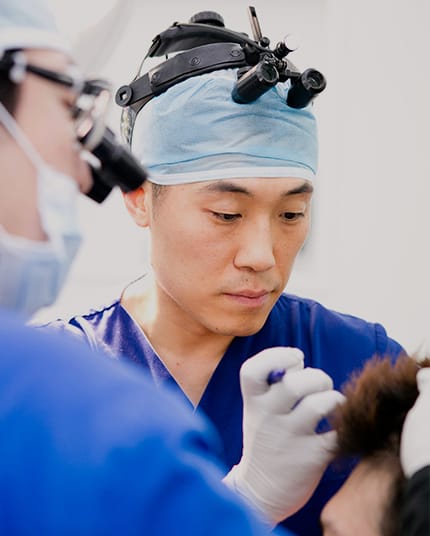 無切開毛髪移植