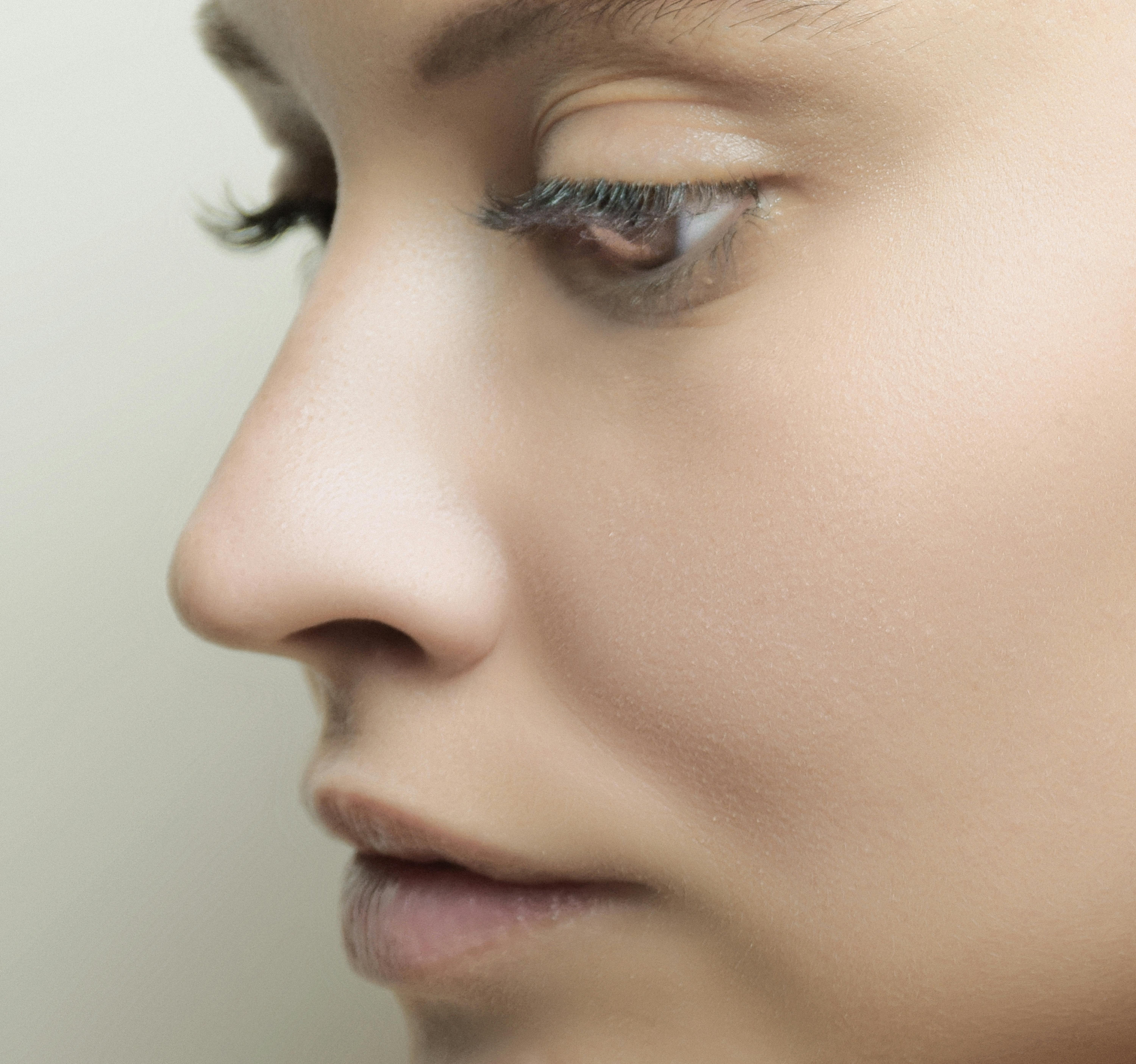 Alar Reduction (Nostril Reduction Surgery)