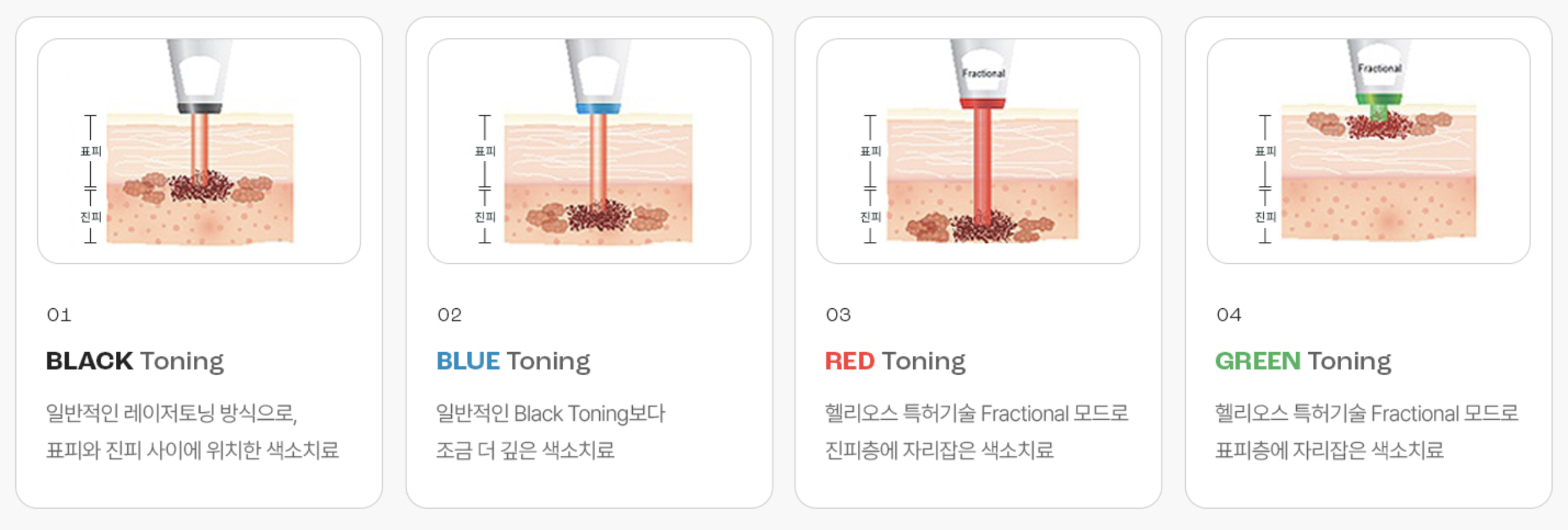 トーニングレーザー