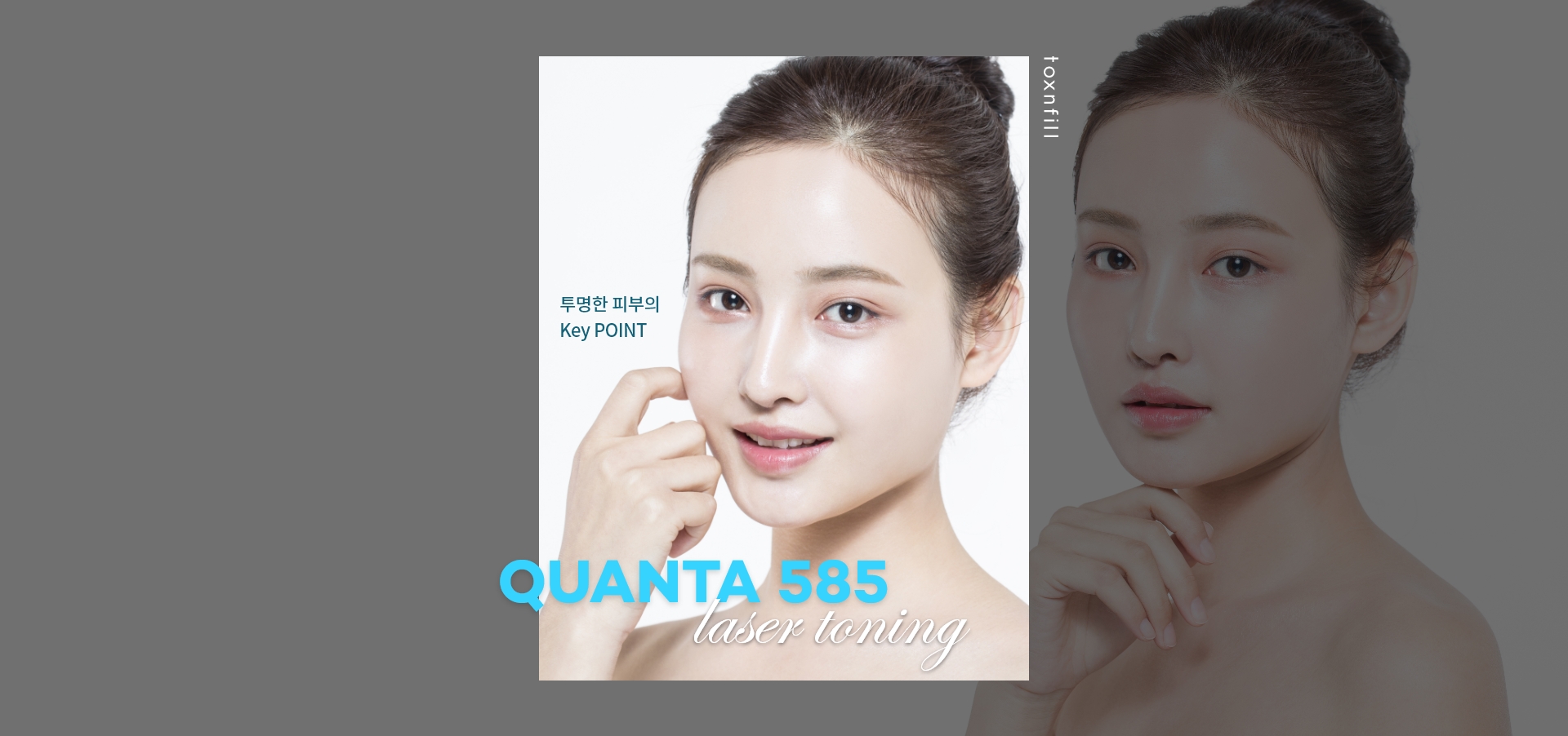 퀀타 585 레이저