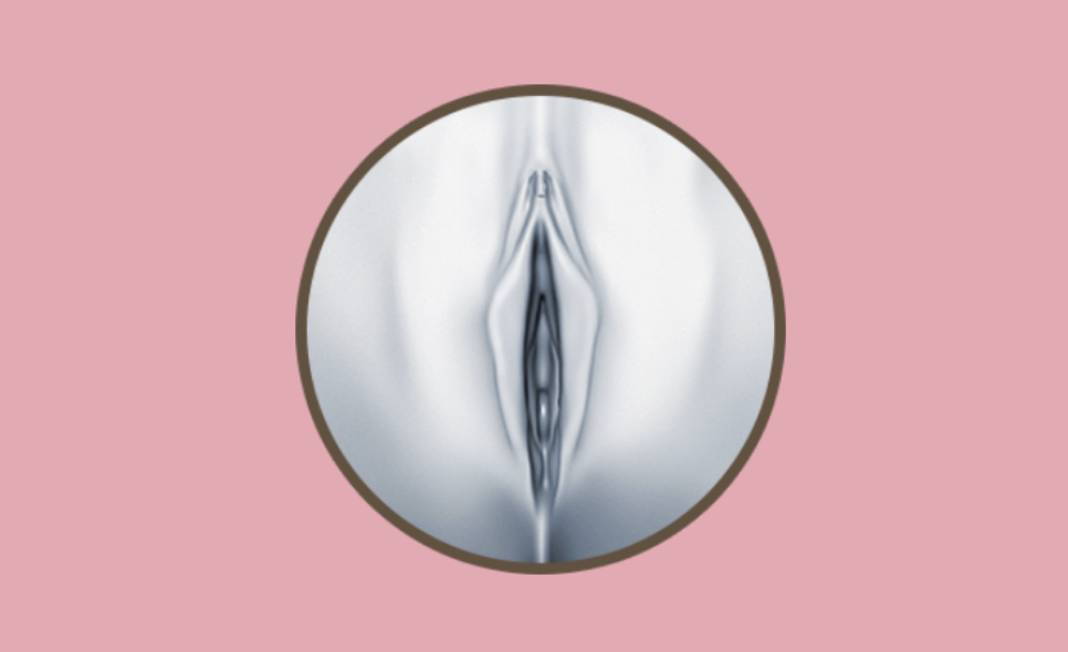 阴道回春术(阴道成形术)