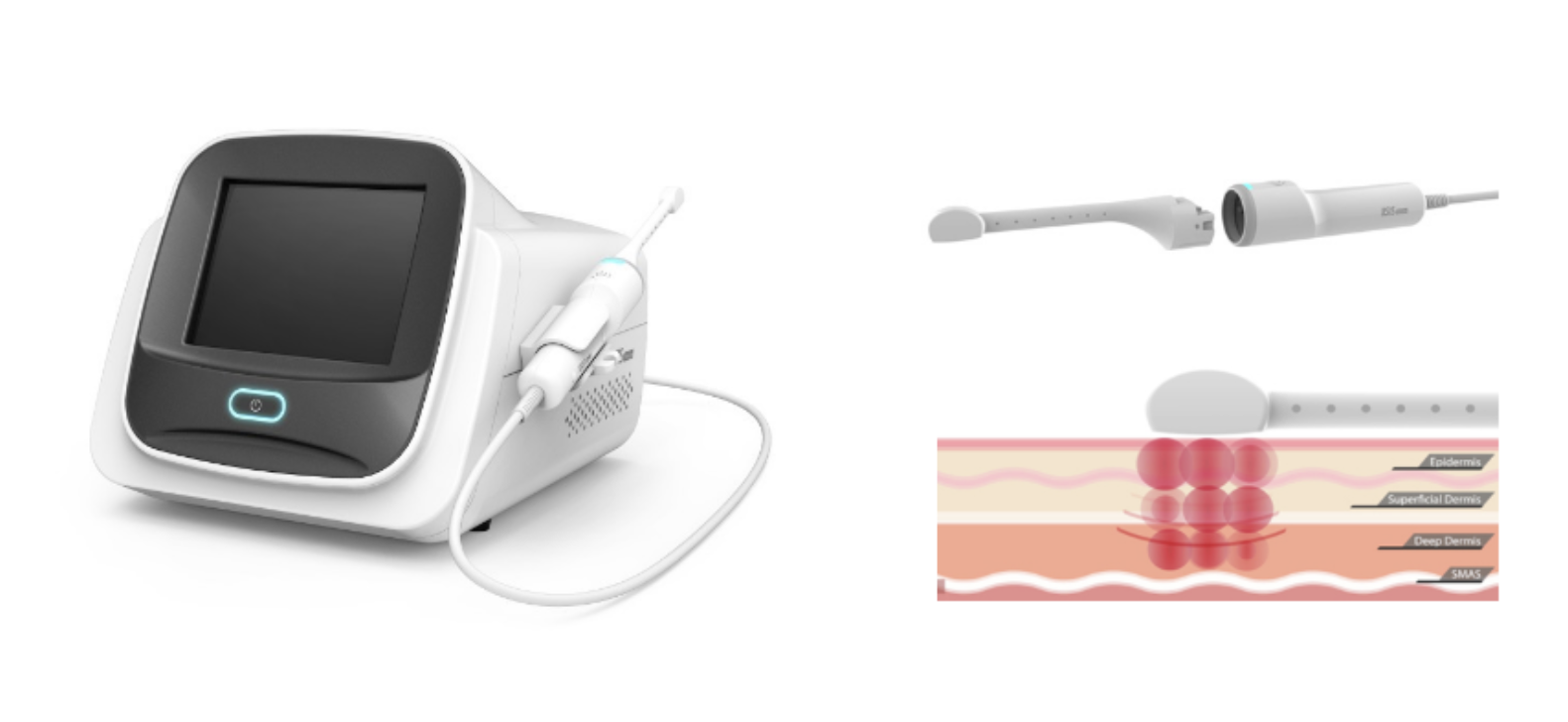 リヴァイブ膣引き締め(RF膣若返り術)