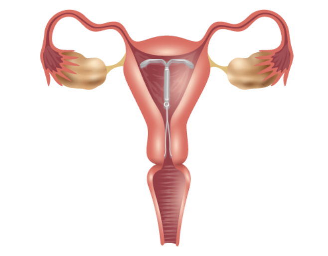 避孕与生育控制管理