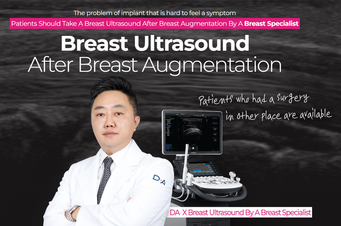 Breast Ultrasound After Breast Augmentation