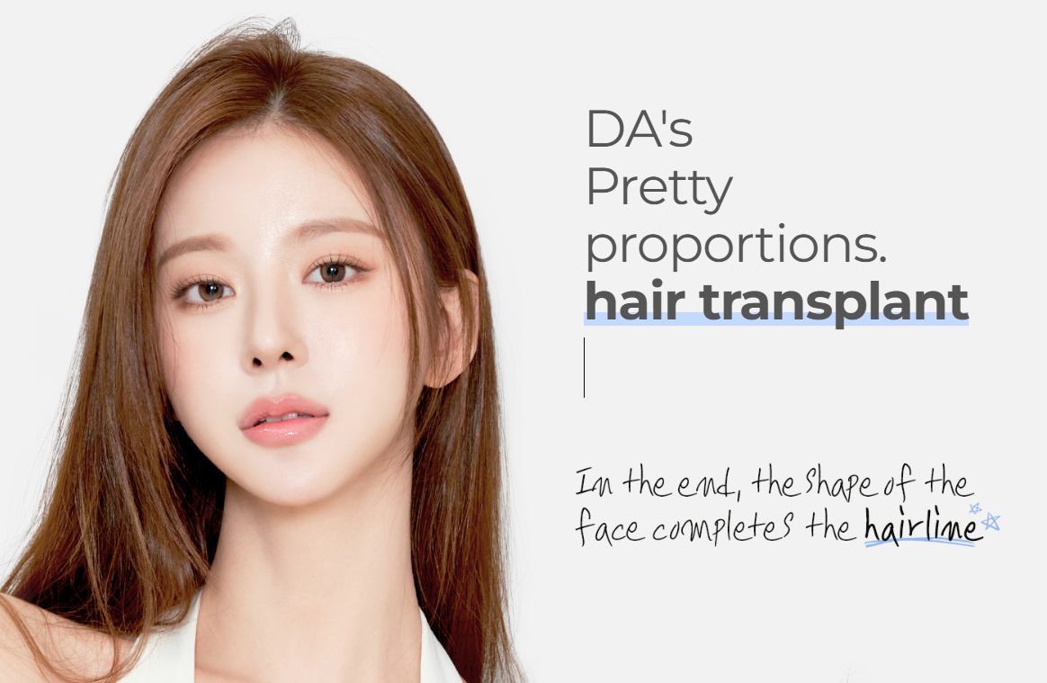 여성 헤어라인 이식