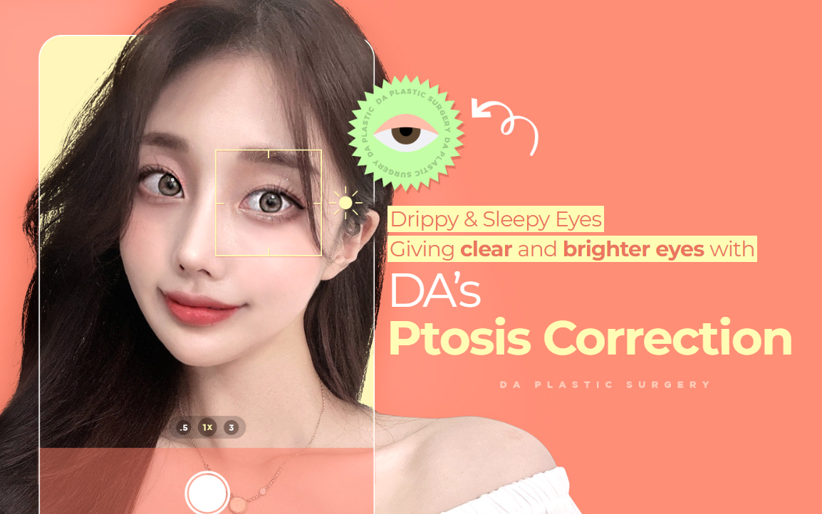 Ptosis Correction