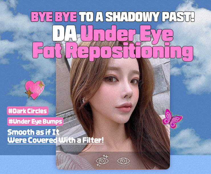 눈 밑 지방 재배치