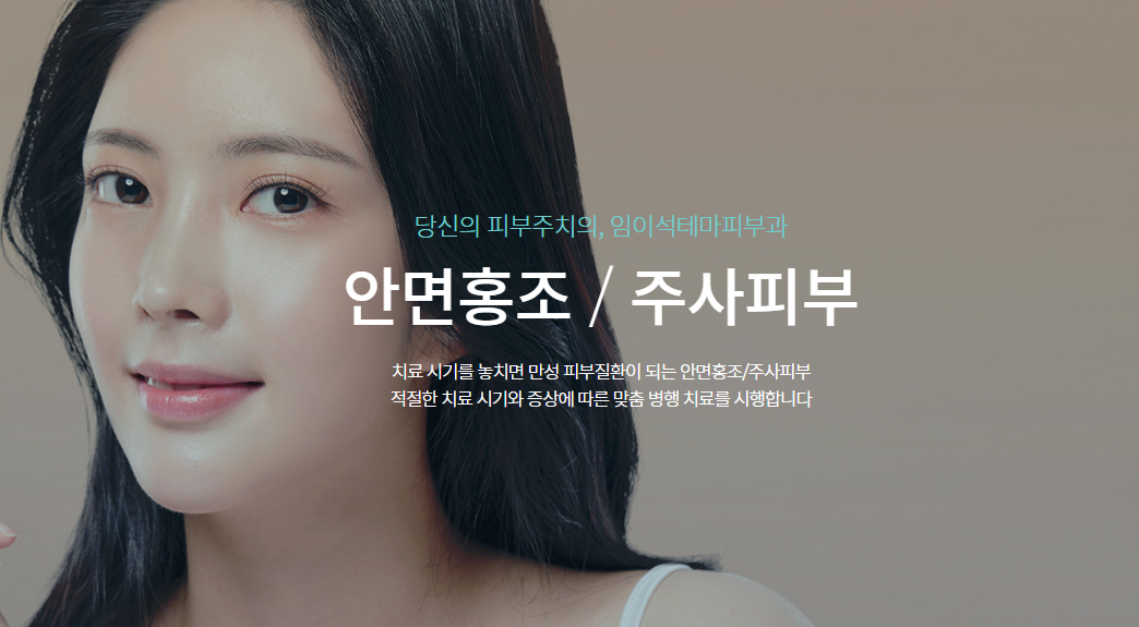 酒さ・顔面紅潮治療