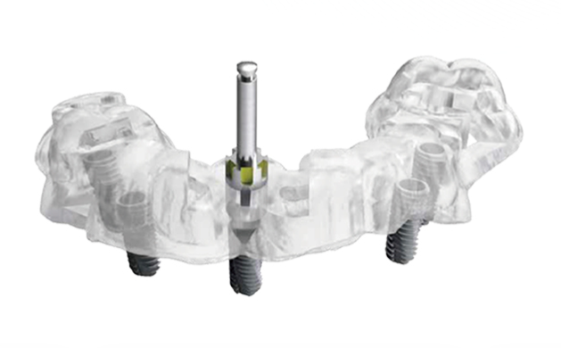 ガイド下歯科インプラント手術