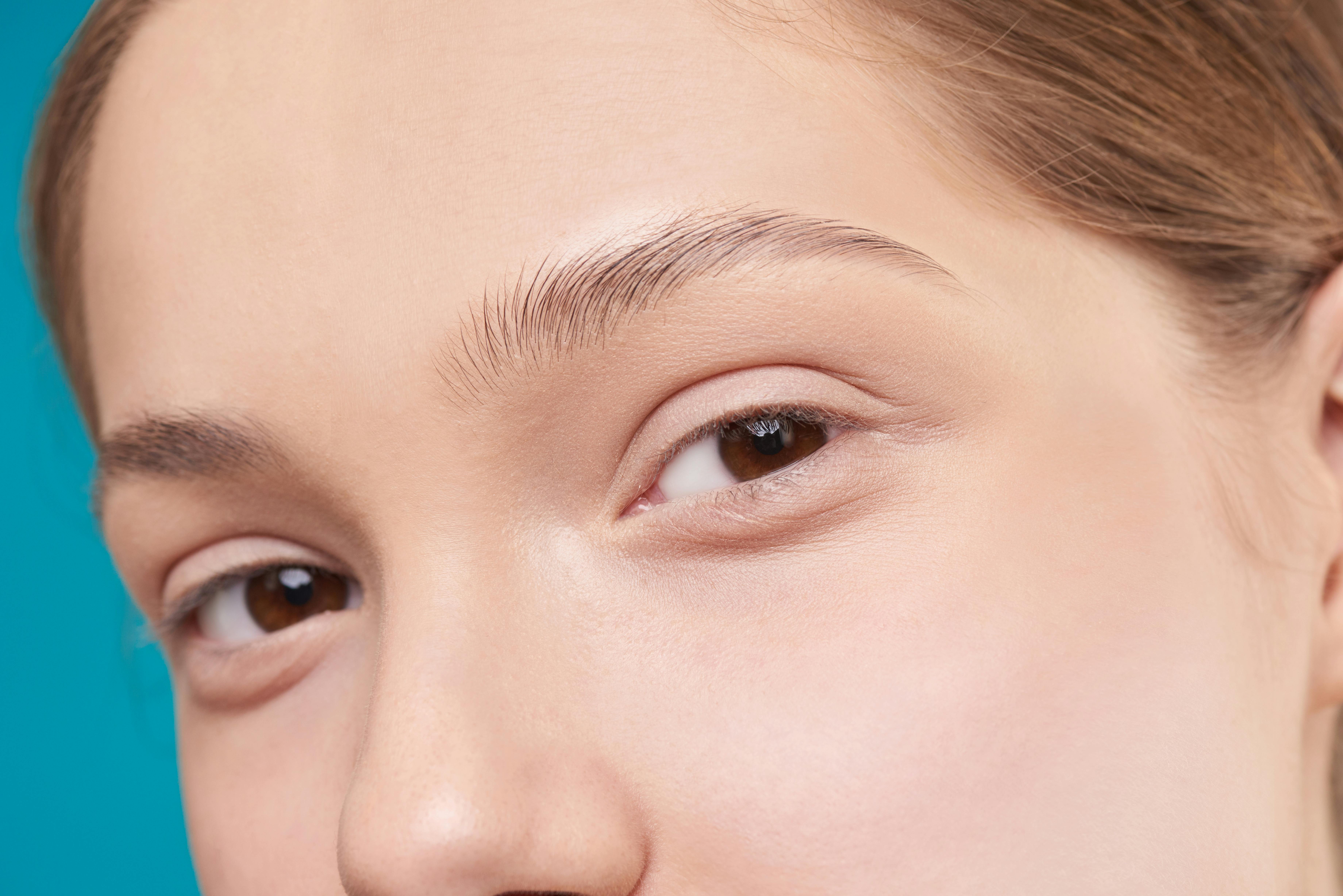 Under-Eye Fat Repositioning